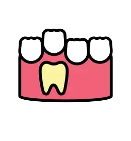 Tooth Eruption Tooth Eruption