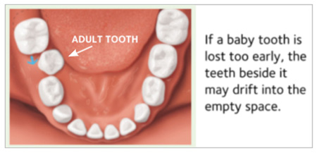 Adult-Tooth Adult-Tooth
