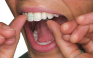 Flossing 3 Flossing 3