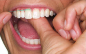 Flossing 4 Flossing 4
