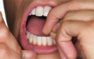 Flossing 5 Flossing 5