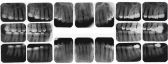 Complete X-Ray Complete X-Ray