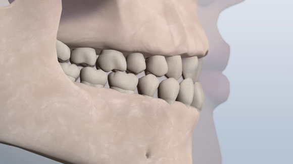 Dental Dental