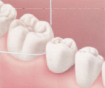 Flossing-under-a-bridge1 Flossing-under-a-bridge1