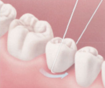 Flossing-under-a-bridge2 Flossing-under-a-bridge2