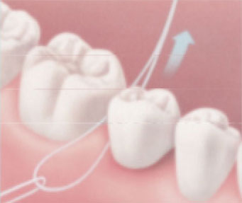 Flossing-under-a-bridge Flossing-under-a-bridge