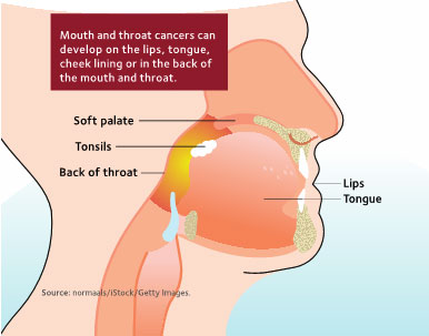 Mouth Cancer Mouth Cancer