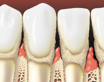 Periodontics Periodontics