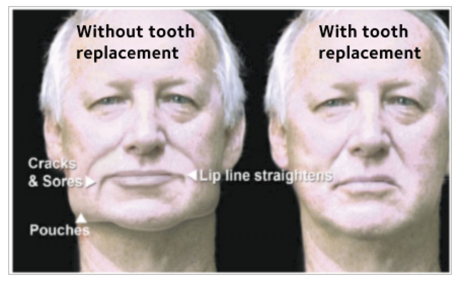 With-and-Without-Replacement With-and-Without-Replacement