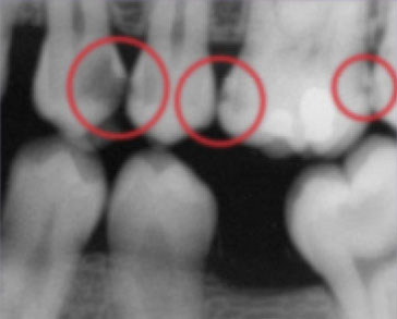 X-Ray-1 X-Ray-1