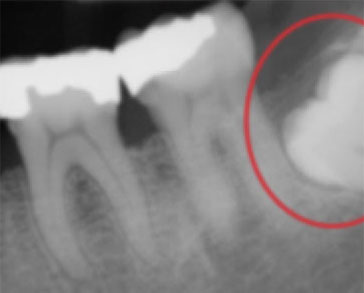 X-Ray-2 X-Ray-2