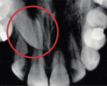 X-Ray-3 X-Ray-3